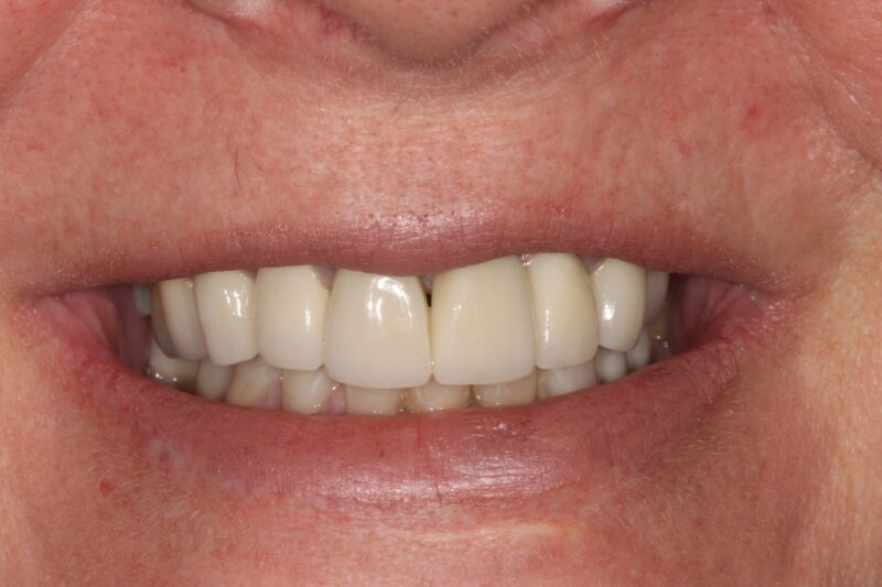 After - Cheadle Hulme Dental