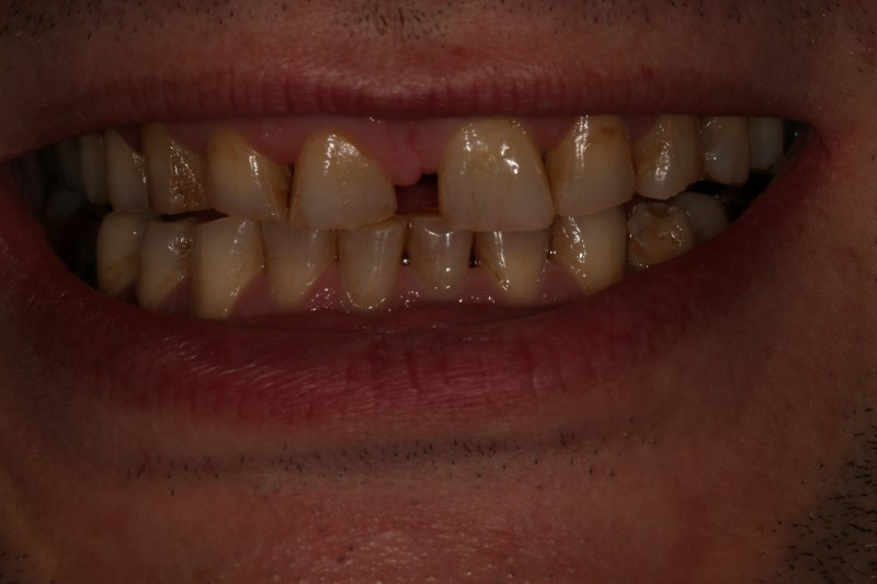 Before - Cheadle Hulme Dental