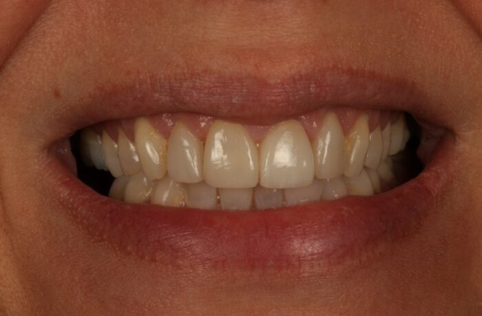 After - Cheadle Hulme Dental