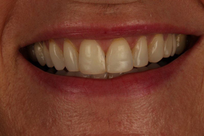 After - Cheadle Hulme Dental