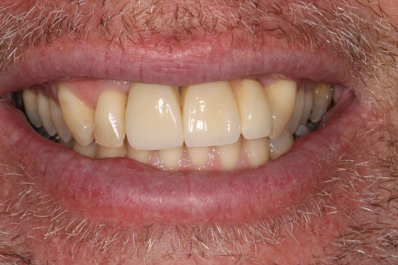 After - Cheadle Hulme Dental