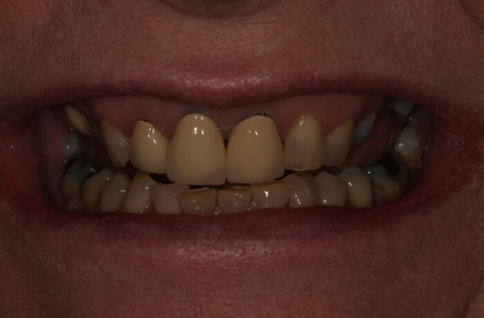 Before - Cheadle Hulme Dental