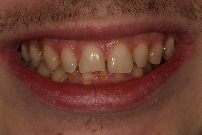 Before - Cheadle Hulme Dental