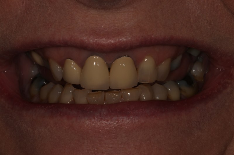 Before - Cheadle Hulme Dental