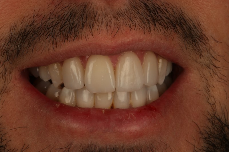 After - Cheadle Hulme Dental