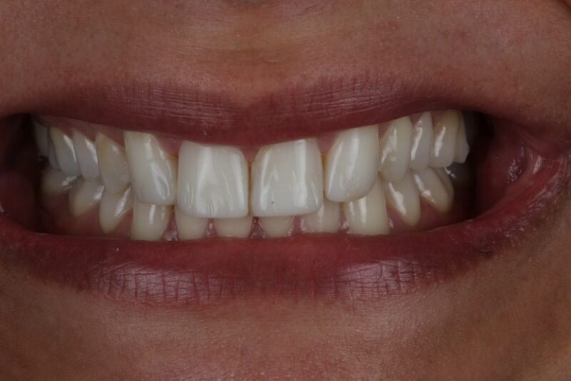 After - Cheadle Hulme Dental