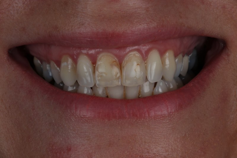 Before - Cheadle Hulme Dental