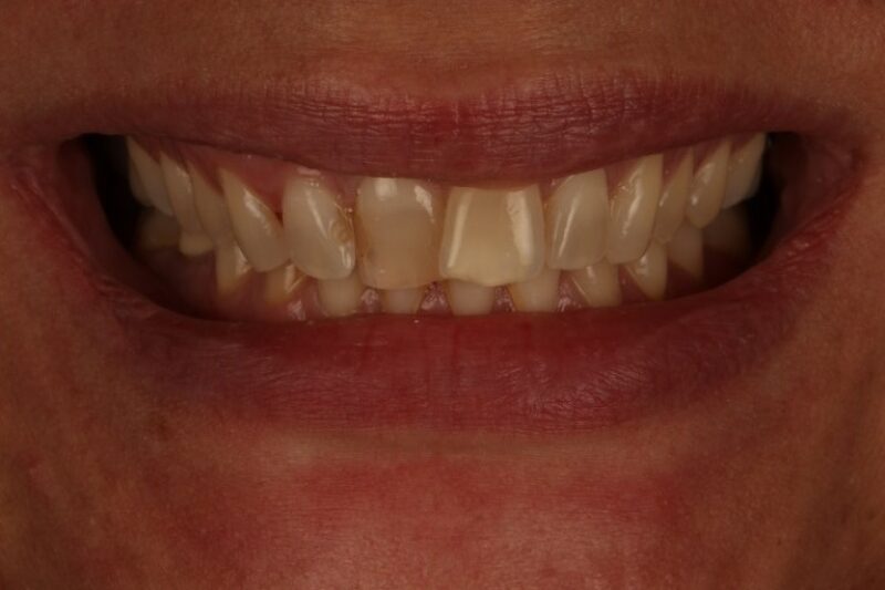 Before - Cheadle Hulme Dental