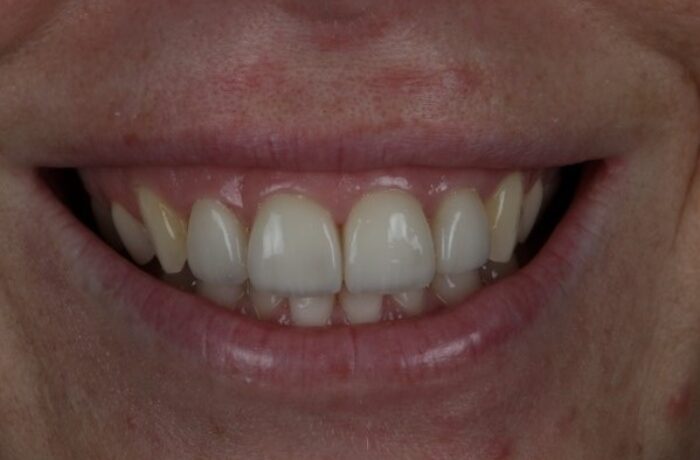 After - Cheadle Hulme Dental