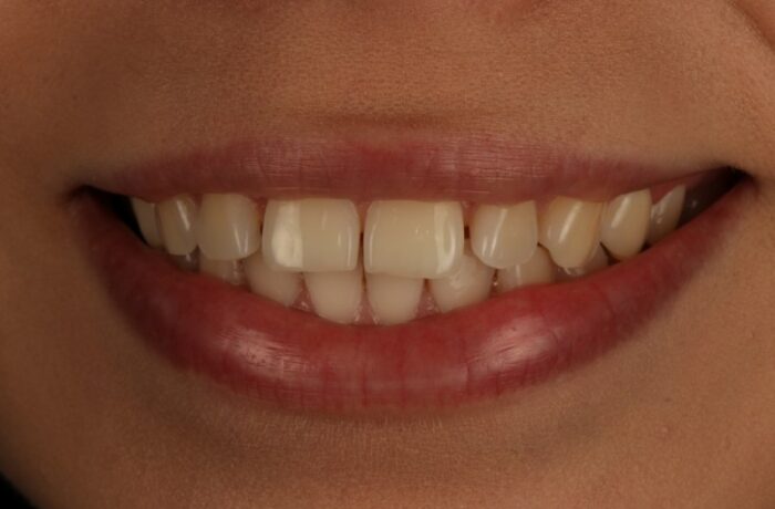 Before - Cheadle Hulme Dental