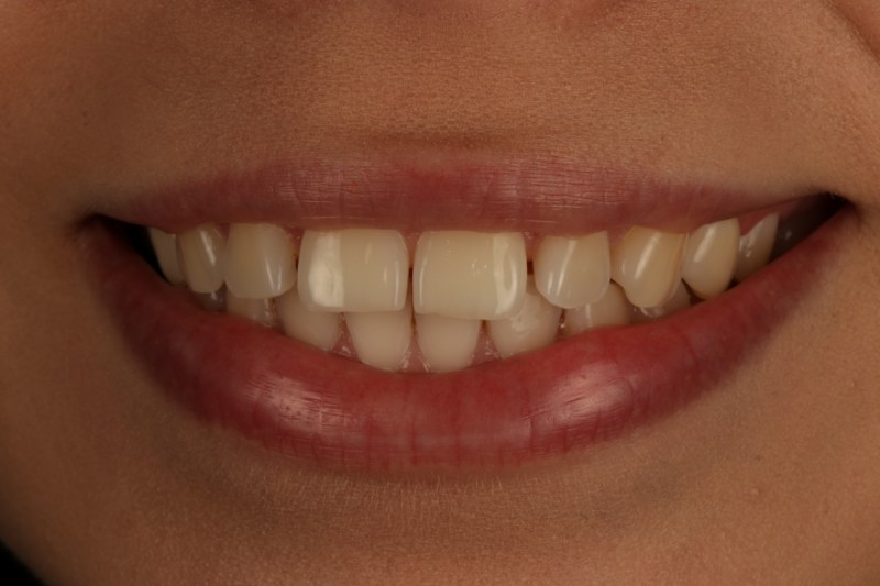 Before - Cheadle Hulme Dental