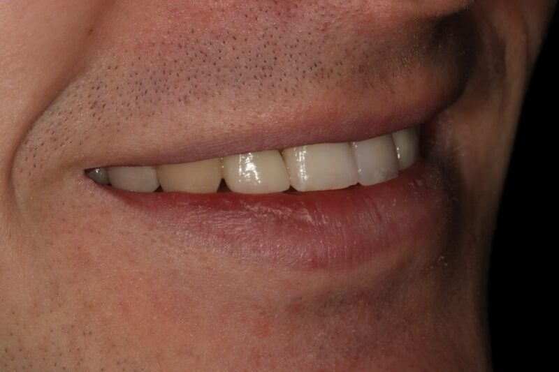 After - Cheadle Hulme Dental