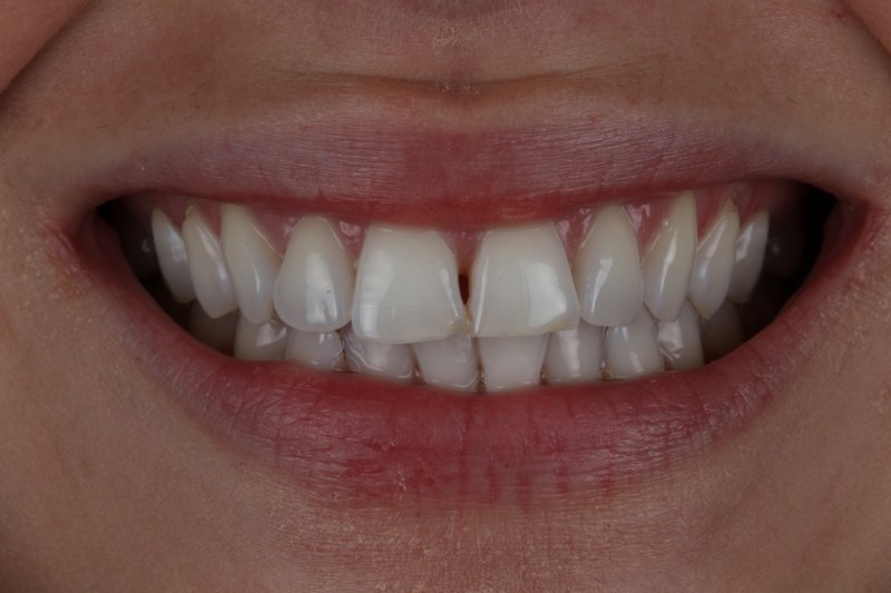 Before - Cheadle Hulme Dental