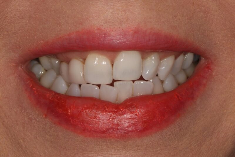 Before - Cheadle Hulme Dental