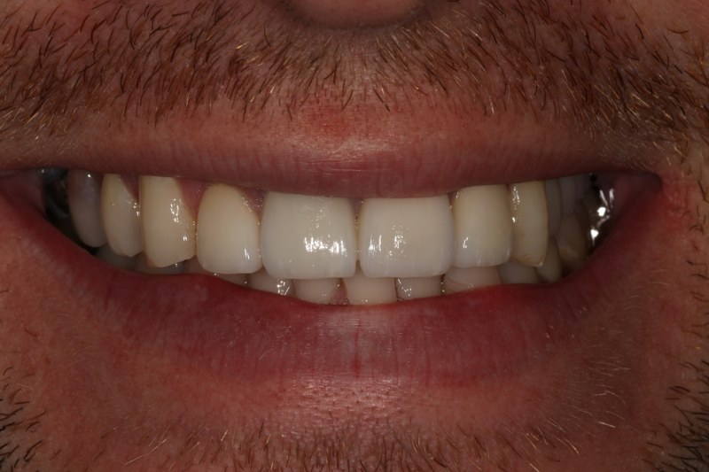 After - Cheadle Hulme Dental