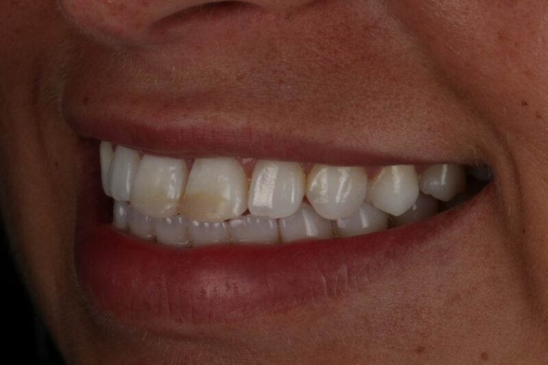 Before - Cheadle Hulme Dental