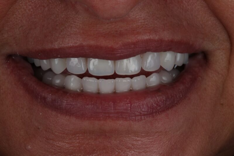 After - Cheadle Hulme Dental