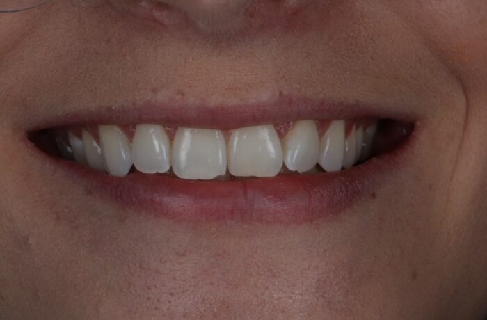 Before - Cheadle Hulme Dental