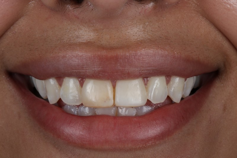 Before - Cheadle Hulme Dental