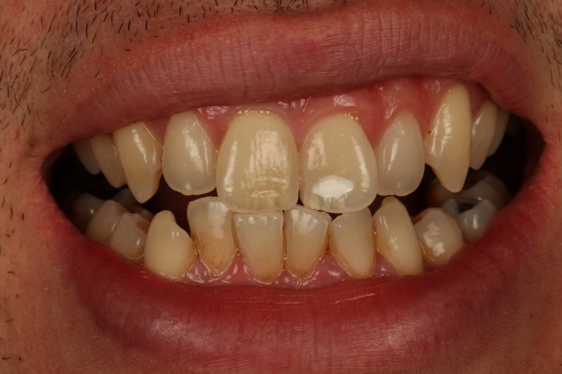 Before - Cheadle Hulme Dental