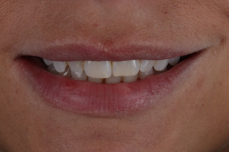 Before - Cheadle Hulme Dental