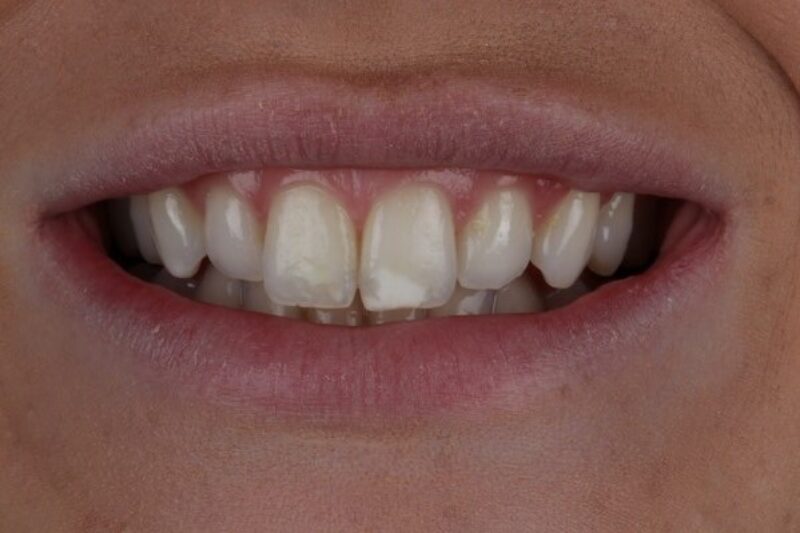 Before - Cheadle Hulme Dental