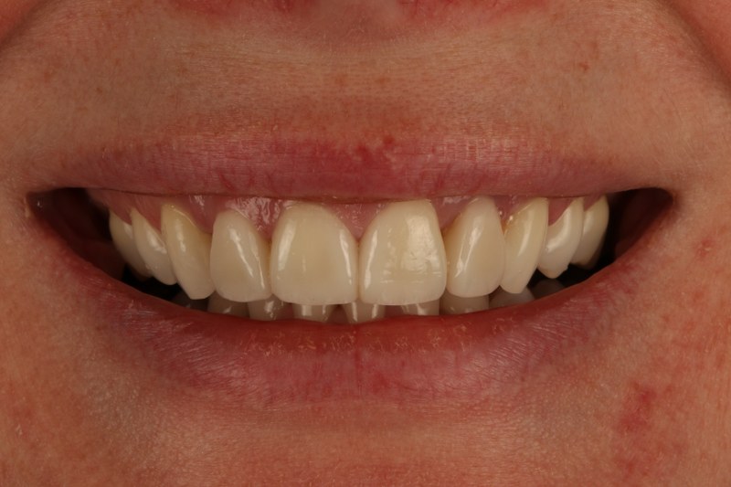 After - Cheadle Hulme Dental