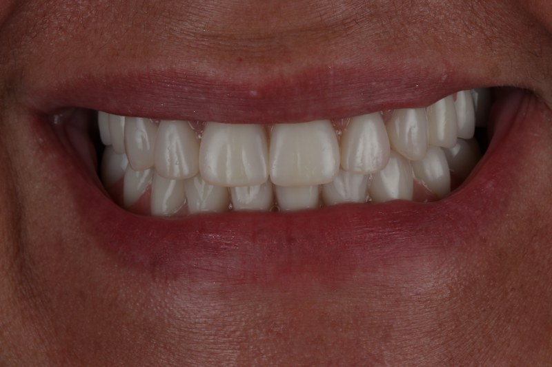 After - Cheadle Hulme Dental