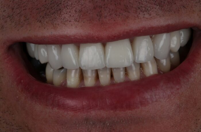 After - Cheadle Hulme Dental