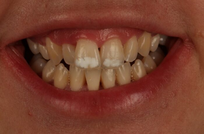 Before - Cheadle Hulme Dental