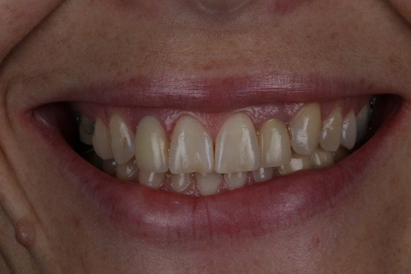 Before - Cheadle Hulme Dental