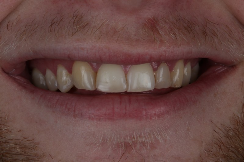 Before - Cheadle Hulme Dental