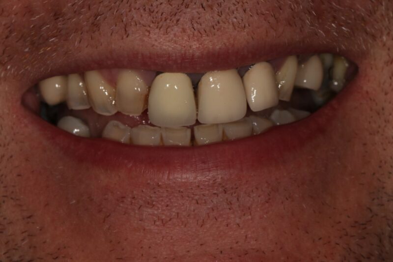 Before - Cheadle Hulme Dental