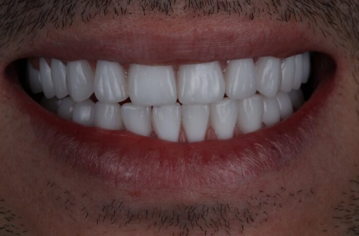 After - Cheadle Hulme Dental