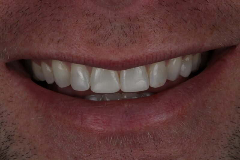 After - Cheadle Hulme Dental