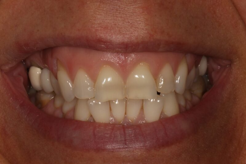 Before - Cheadle Hulme Dental