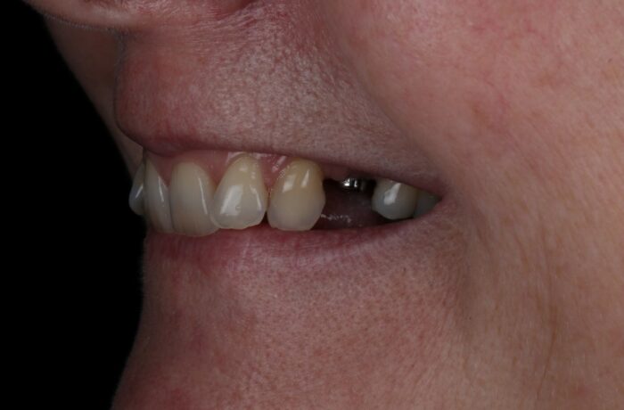 Before - Cheadle Hulme Dental