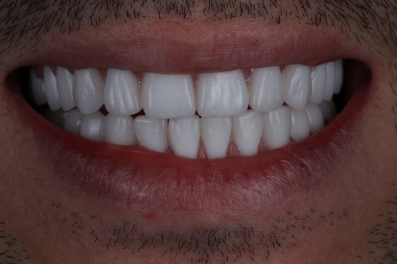 After - Cheadle Hulme Dental