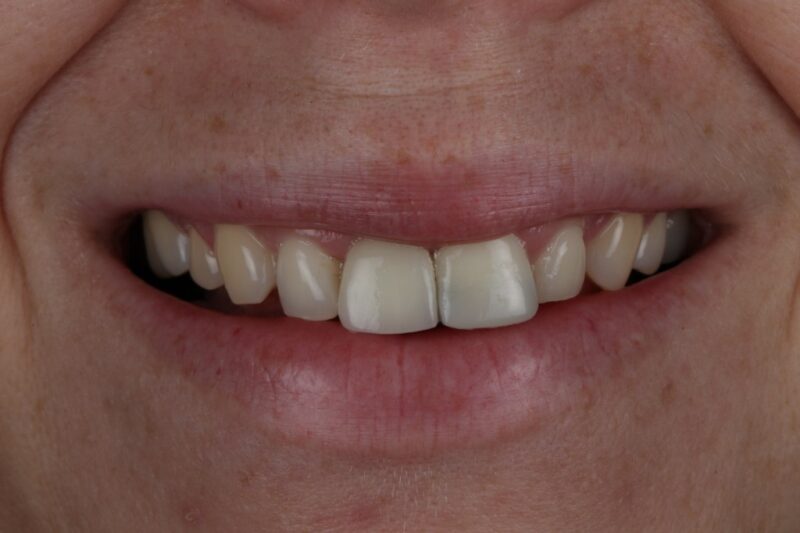 After - Cheadle Hulme Dental