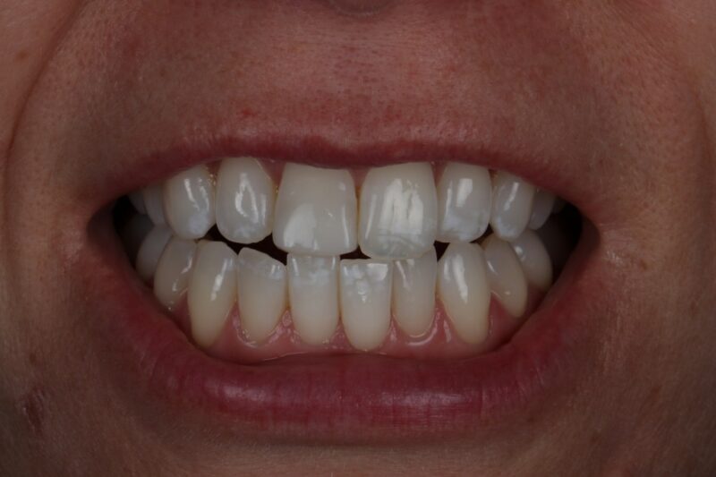 After - Cheadle Hulme Dental