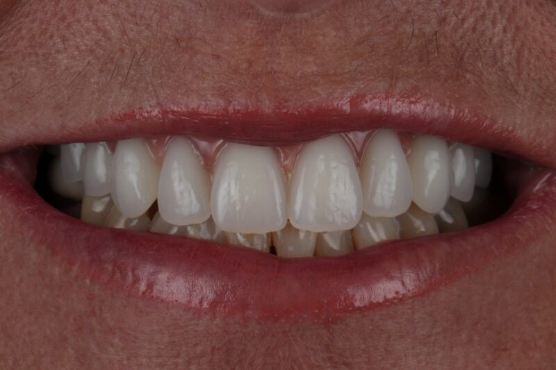 After - Cheadle Hulme Dental