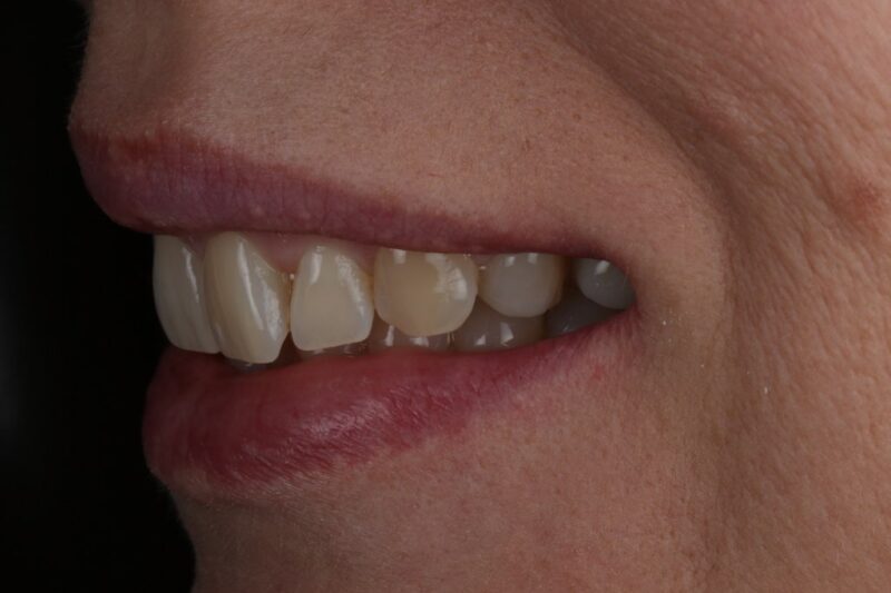 After - Cheadle Hulme Dental