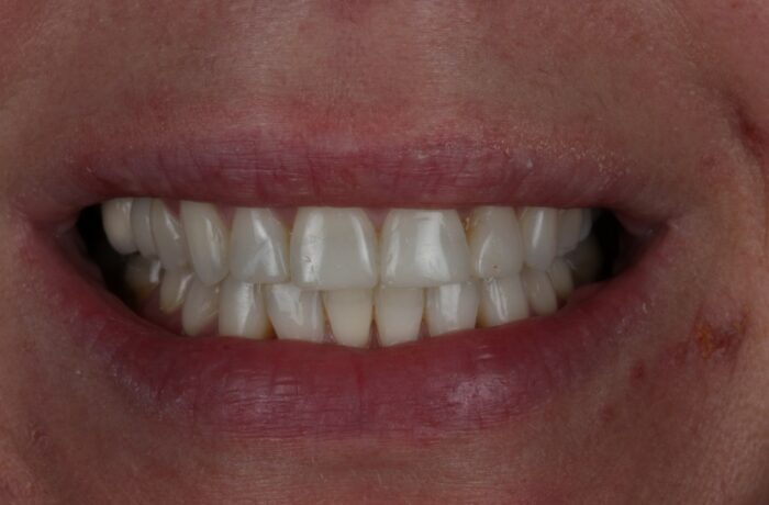 After - Cheadle Hulme Dental