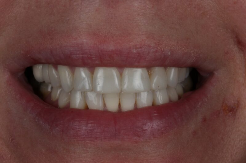 After - Cheadle Hulme Dental