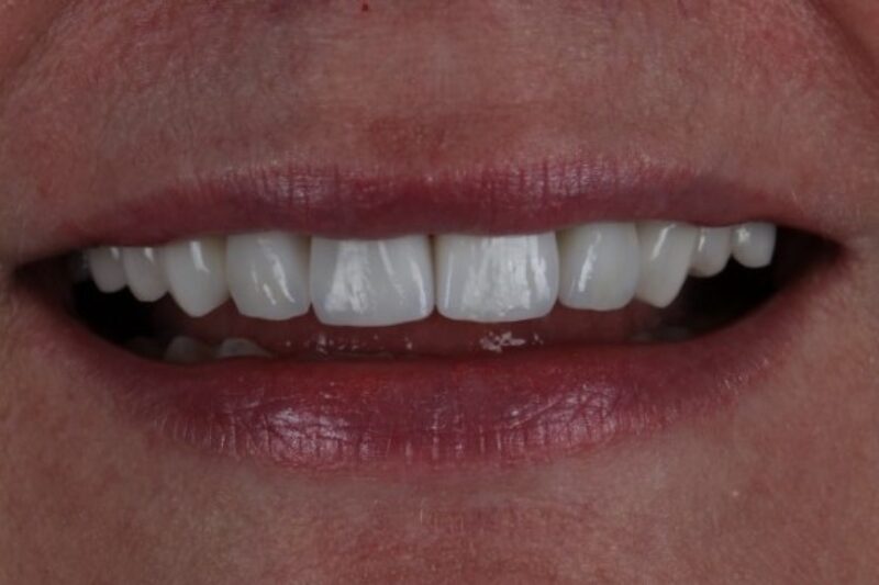 After - Cheadle Hulme Dental