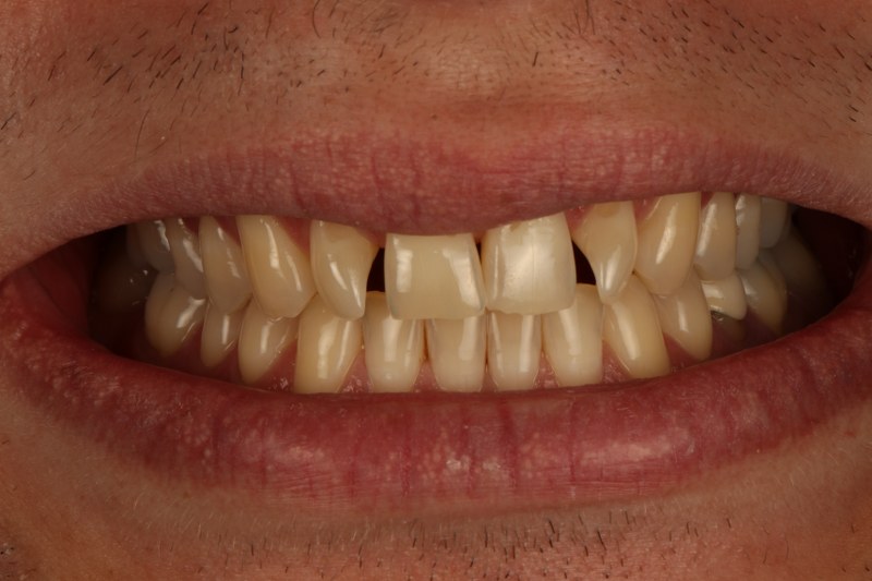 Before - Cheadle Hulme Dental