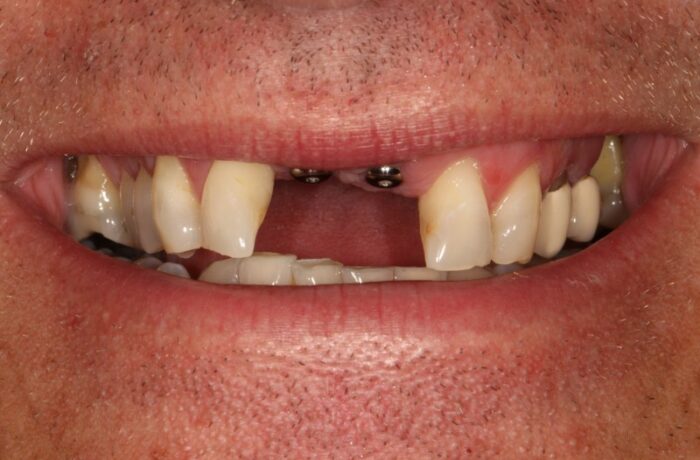 Before - Cheadle Hulme Dental