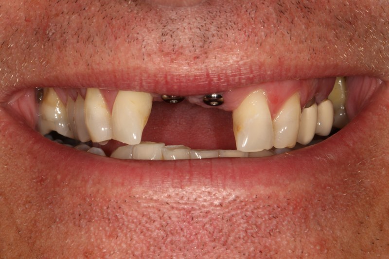 Before - Cheadle Hulme Dental