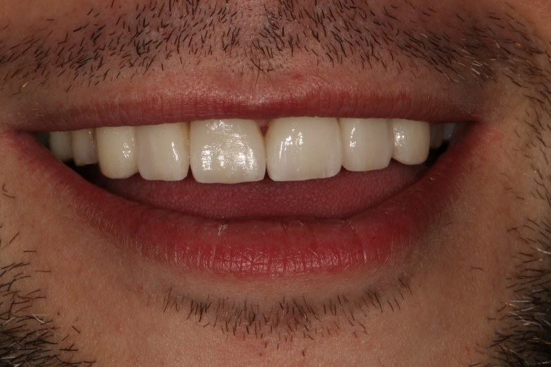 After - Cheadle Hulme Dental