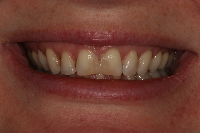 Before - Cheadle Hulme Dental